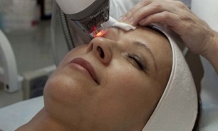 blepharoplasty untuk meremajakan kulit di sekitar mata