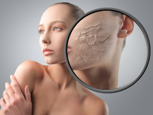 perawatan wajah 30 tahun untuk kulit kering
