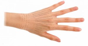 Situs injeksi untuk tangan selama biorevitalisasi